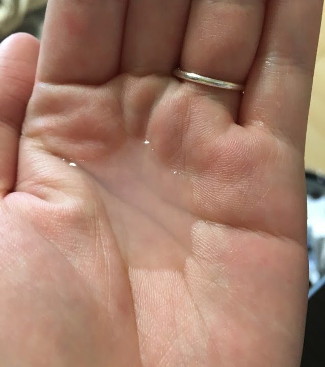 美白化粧水(約20回分)